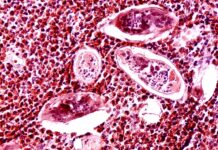 La amenaza de los gusanos de la esquistosomiasis, la enfermedad emergente que ya se ha transmitido en España